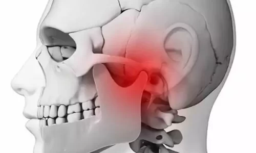 Articulación temporomandibular y su relación con el dolor cervicocraneal